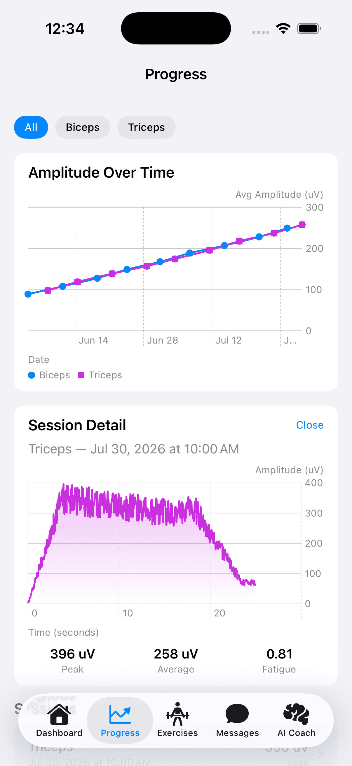 Real-time EMG visualization in Swift Charts, both arms side by side.
