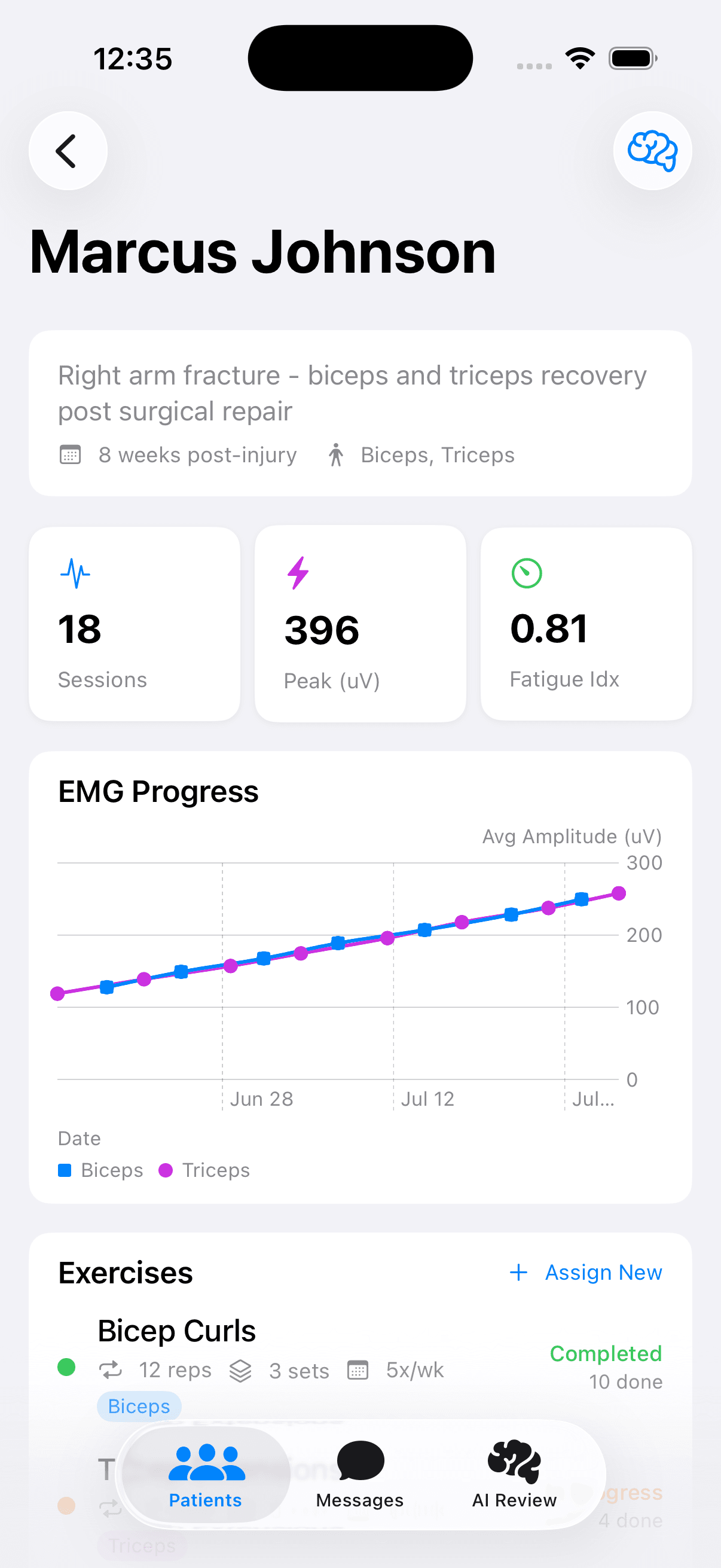 Provider view — sessions, trends, and bilateral asymmetry over time.